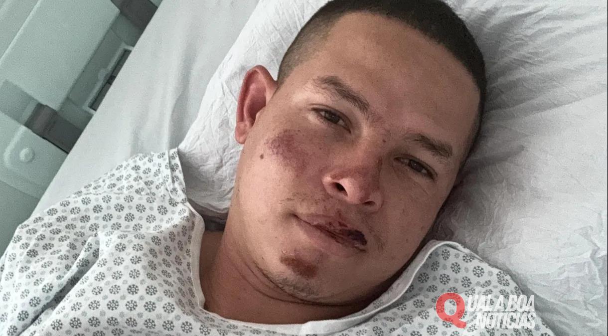 À CNN, paraquedista que caiu em balão relata “quase morte”: “Pensei na minha filha”