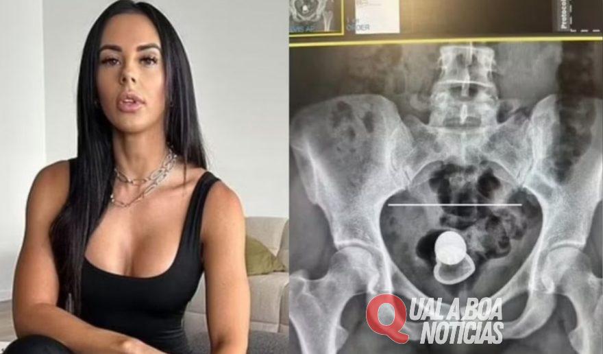 Atriz de conteúdo adulto Alicia Davis, fica com 'plug anal' preso no corpo e precisa ser sedada