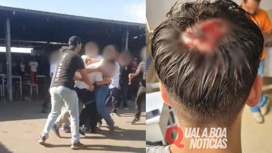 No Paraná: Adolescente leva nove pontos na cabeça após ser agredido a cadeiradas em escola