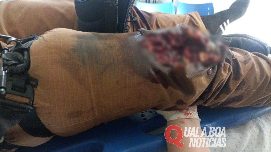 Na Região: Policial feminina sofre ferimentos graves após disparo acidental de arma calibre .12