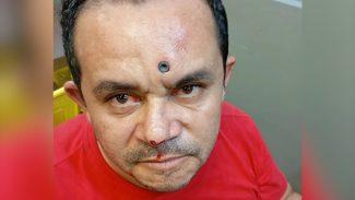 Episódio de violência: Homem mata desafeto a facadas, leva tiro e projétil fica cravado na testa
