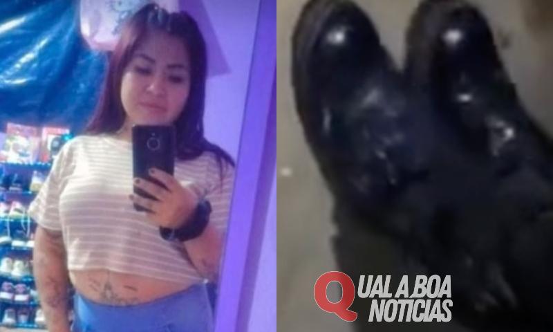 “Não me mata, por favor!”: jovem implora pela vida antes de ter cabeça metralhada por bandidos; veja vídeo