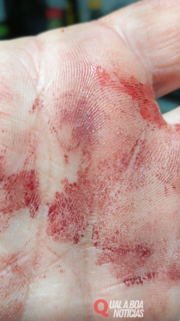 Morador de Nova Santa Rosa relata ter sido agredido na PR-589 próximo à Novo Sarandi